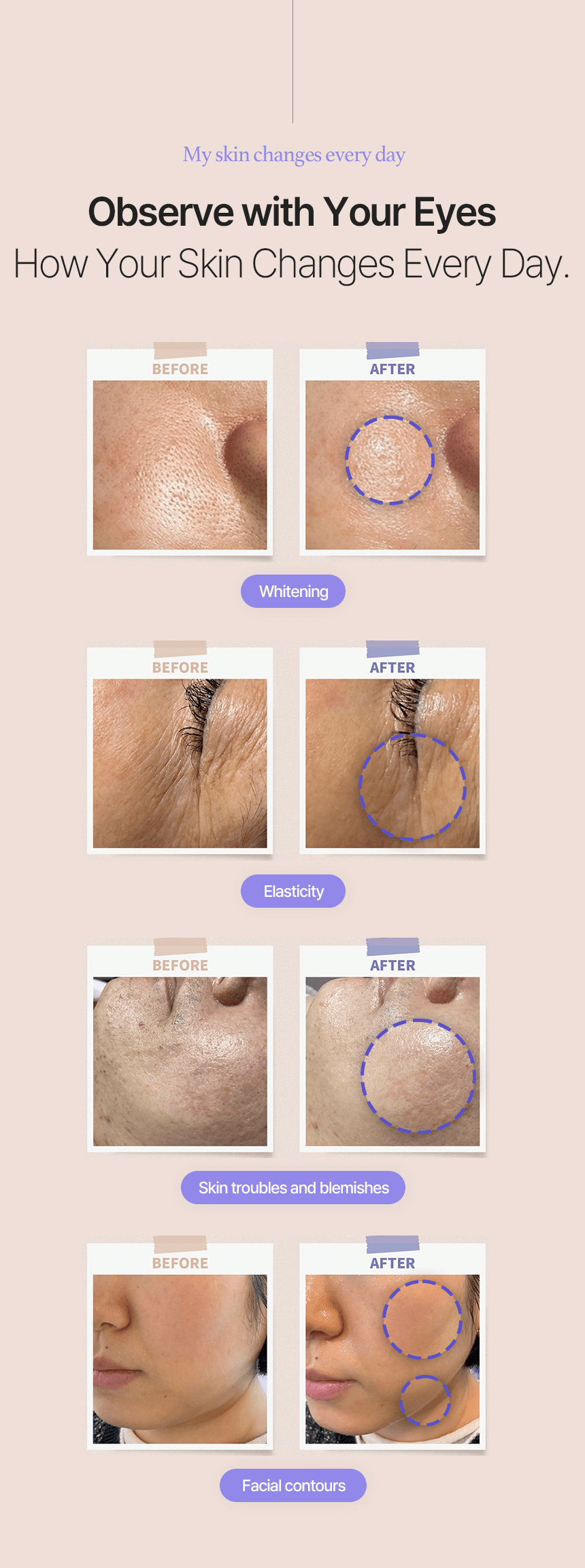 EstellaMOM [Postpartum maternity] ultrasonic skincare device for body and face - Korean Ultrasound Beauty Devices | Estella OfficialPortable