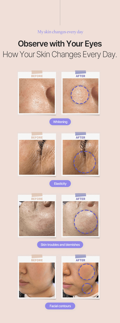EstellaMOM [Postpartum maternity] ultrasonic skincare device for body and face - Korean Ultrasound Beauty Devices | Estella OfficialPortable