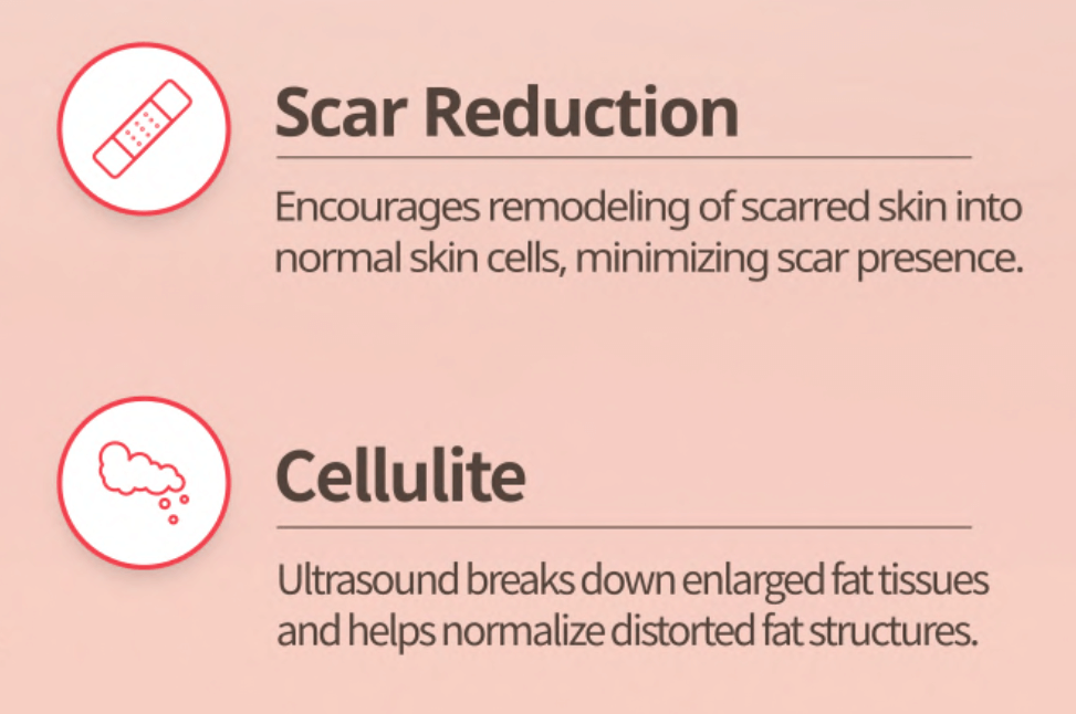 EstellaMOM [Postpartum maternity] ultrasonic skincare device for body and face - Korean Ultrasound Beauty Devices | Estella OfficialPortable